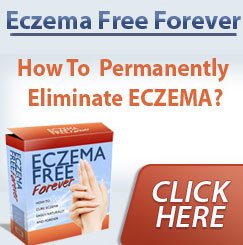 eczema free forever