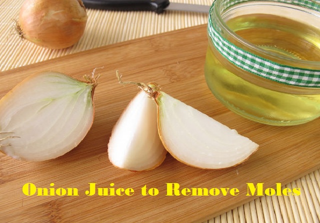onion juice for mole removal