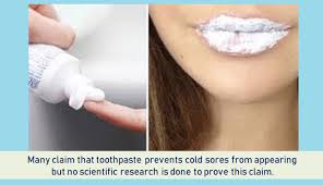 toothpaste for cold sore